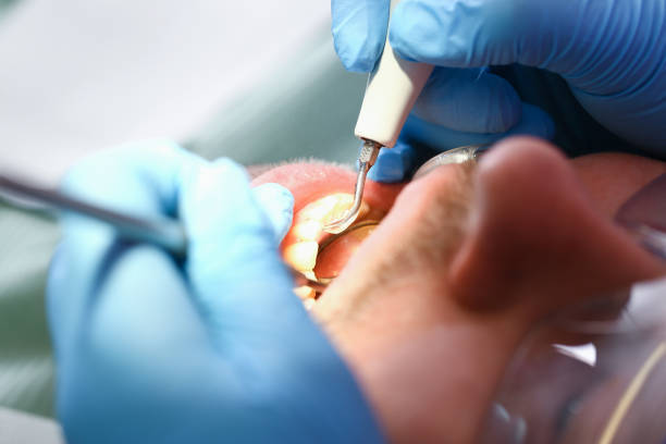 Best Urgent Dental Care for Toothache in Montclair State University, NJ